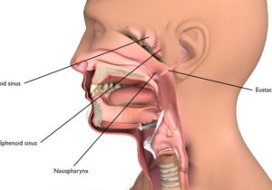 To Lower Your Risk of Throat Cancer, Avoid Here is 3 Three Risk Factors