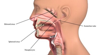 To Lower Your Risk of Throat Cancer, Avoid Here is 3 Three Risk Factors