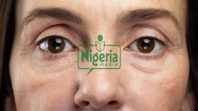 Common Signs That A Woman Is Starting To Age