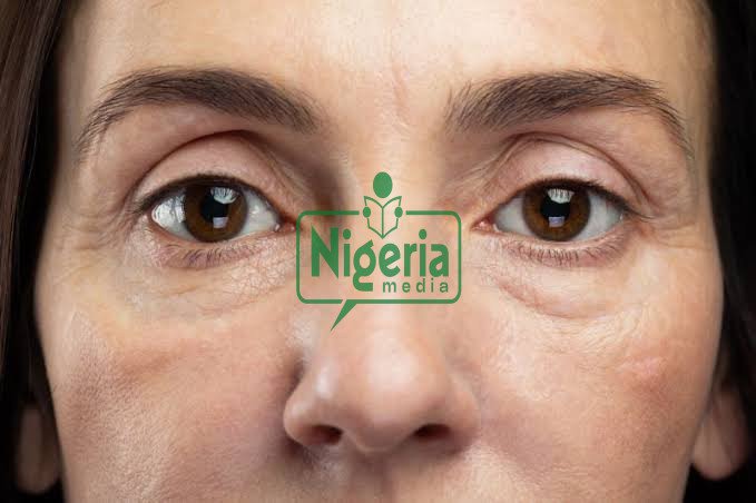 Common Signs That A Woman Is Starting To Age Common Signs That A Woman Is Starting To Age