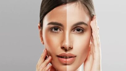 Common Ways On How To Lighten Your Skin Naturally