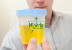 Here is Home Based HIV Testing Using Urine
