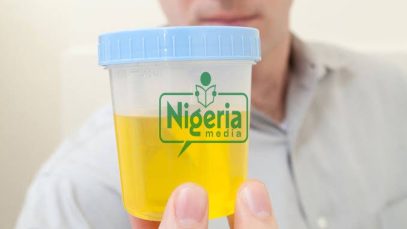 Here is Home Based HIV Testing Using Urine