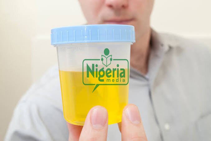 Here is Home Based HIV Testing Using Urine