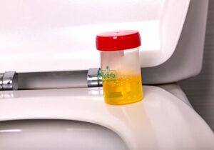 If Your Urine Always Foams, These Are It’s 5 Five Possible Causes And Foods To Watch Out For