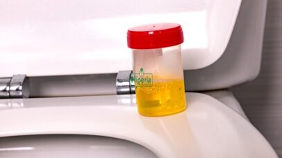 If Your Urine Always Foams, These Are It’s 5 Five Possible Causes And Foods To Watch Out For