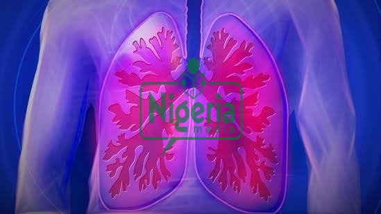 Your Lungs Are Not In Good Condition If You Experience The Following (JUST-IN) Your Lungs Are Not In Good Condition If You Experience The Following (JUST-IN)
