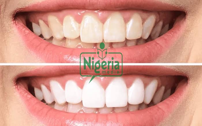 Easy ways How To Make Your Teeth White Again
