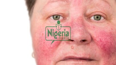 Reasons Why Alcohol Makes Your Skin Look Older And Ugly