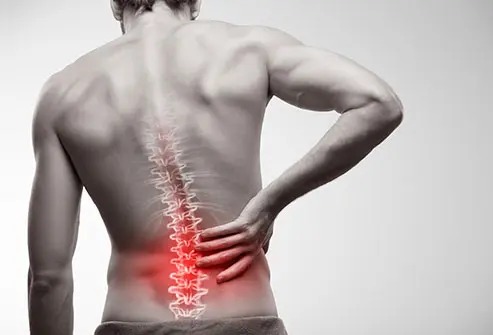 What Causes Lower Back Pain (Discover)