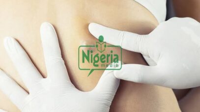 What These Little Bumps On The Skin Are And How To Take Care Of Them (DETAILS)