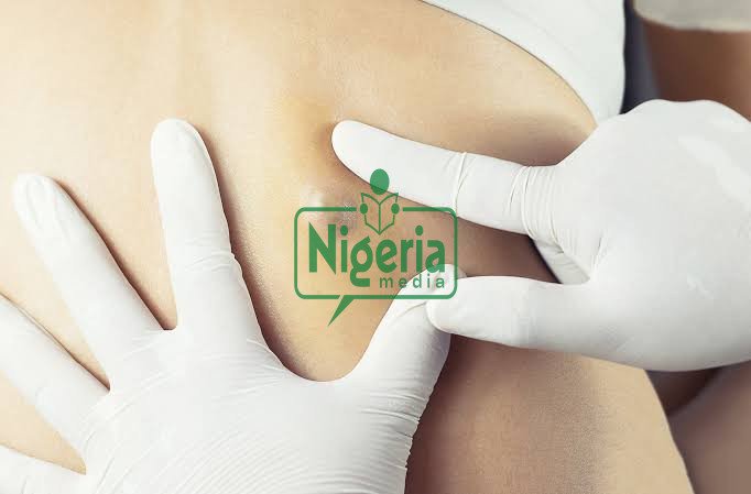 What These Little Bumps On The Skin Are And How To Take Care Of Them (DETAILS) What These Little Bumps On The Skin Are And How To Take Care Of Them (DETAILS)