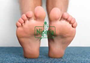 Here is the Health Conditions That Can Cause Burning Sensation On Your Feet