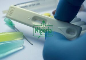 After Conducting HIV Virus, These Are The Number Of Days You Will Take To Test positive (BREAKING)
