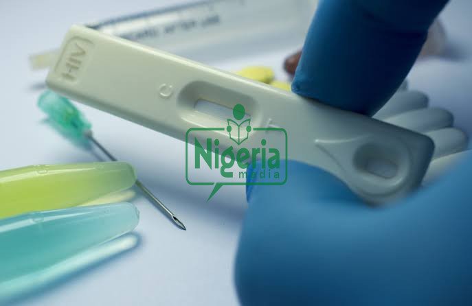 After Conducting HIV Virus, These Are The Number Of Days You Will Take To Test positive (BREAKING)