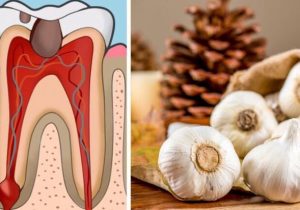 Here are Home Remedies for Toothache Instead of Going to the Dentist