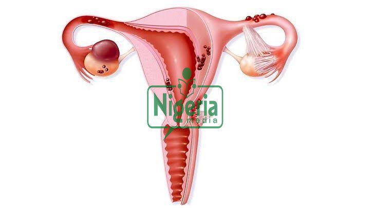 Causes Of Painful Periods And How To Stop It (JUST IN)