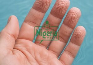 Wrinkled Fingers: What Really Causes Wrinkly Fingers After Encountering Cold Water (DETAILS)