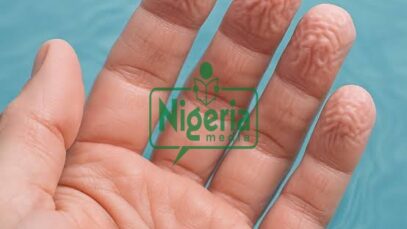 Wrinkled Fingers: What Really Causes Wrinkly Fingers After Encountering Cold Water (DETAILS)