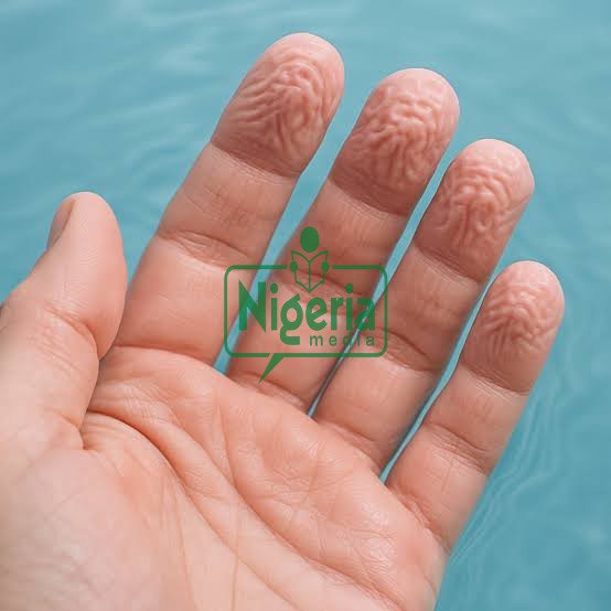 Wrinkled Fingers: What Really Causes Wrinkly Fingers After Encountering Cold Water (DETAILS)