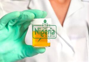 If Your Urine Always Foams, Here Are It’s Following 5 Five Possible Causes And Foods To Watch Out For