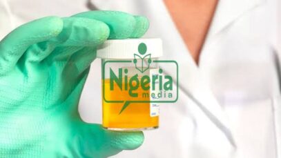 If Your Urine Always Foams, Here Are It’s Following 5 Five Possible Causes And Foods To Watch Out For