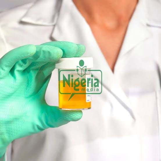 If Your Urine Always Foams, Here Are It’s Following 5 Five Possible Causes And Foods To Watch Out For If Your Urine Always Foams, Here Are It’s Following 5 Five Possible Causes And Foods To Watch Out For