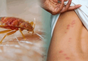10 Ten Effective Tips to Prevent and Control Bed Bugs in Your Home