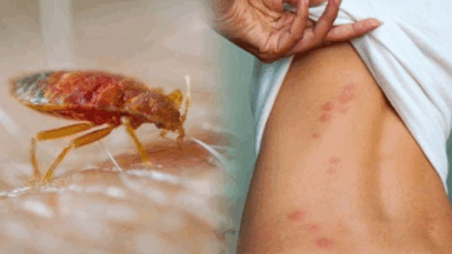 10 Ten Effective Tips to Prevent and Control Bed Bugs in Your Home