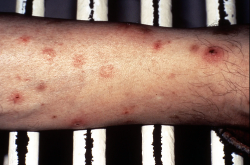 BREAKING NEWS: Important Signs Of Leukemia You Shouldn’t Ignore According To Health Experts BREAKING NEWS: Important Signs Of Leukemia You Shouldn’t Ignore According To Health Experts
