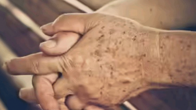 BREAKING: Reasons Why Your Hands Look Old And How To Fix Them BREAKING: Reasons Why Your Hands Look Old And How To Fix Them