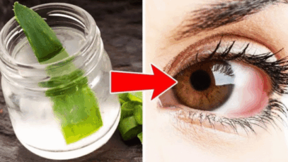 BREAKING: Say Goodbye to Eyeglasses With This Simple Remedy