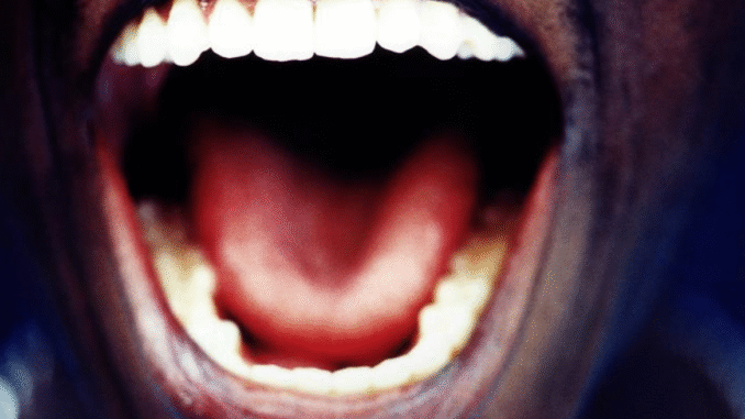 BREAKING NEWS: Tongue and Mouth Signs of HIV BREAKING NEWS: Tongue and Mouth Signs of HIV