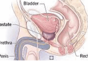 BREAKING NEWS: What Men Should Do To Reduce The Risk Of Prostrate Enlargement As They Grow Older