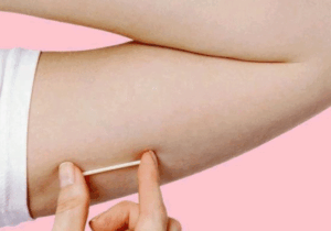 BREAKING NEWS: Side Effects of Contraceptive Implant That You Need To Know