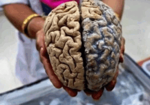 You Are Slowly Killing Your Brain If You Keep Doing These Five Things