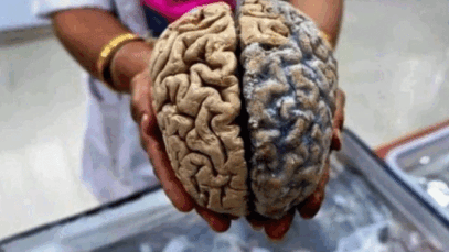 You Are Slowly Killing Your Brain If You Keep Doing These Five Things