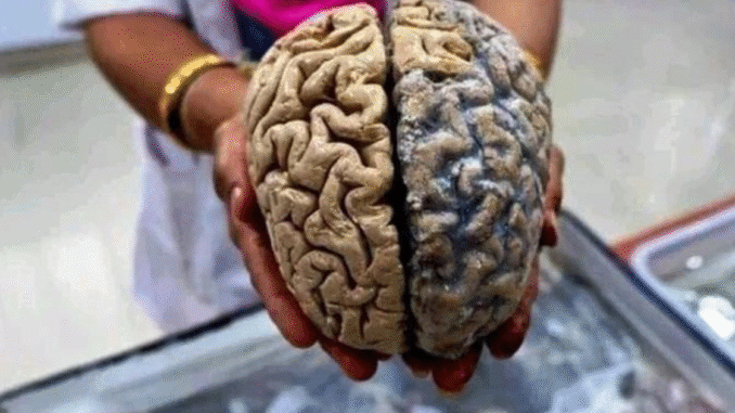 You Are Slowly Killing Your Brain If You Keep Doing These Five Things You Are Slowly Killing Your Brain If You Keep Doing These Five Things