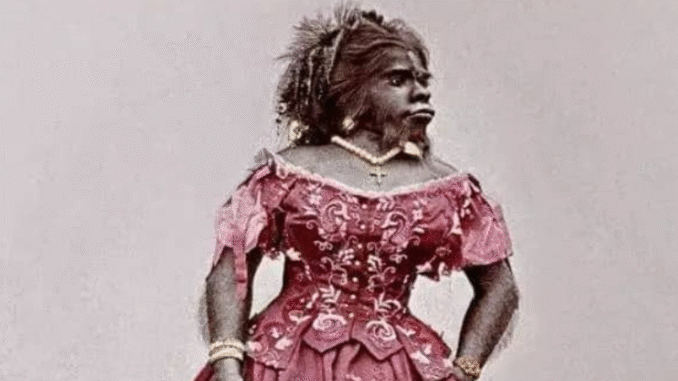 BREAKING: Meet The ‘Ugliest’ Woman In The World & Why She Turned Down Over 20 Marriage Proposals From Men