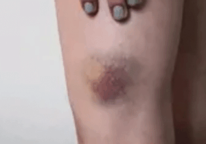 Early warning signs of cancer in your body you should not play with (DETAILS)