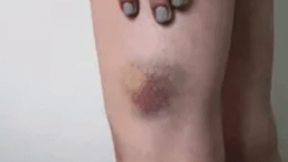Early warning signs of cancer in your body you should not play with (DETAILS)