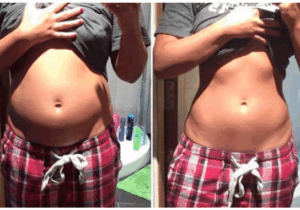 BREAKING NEWS: The real reason why your stomach is bloated and how to fix it