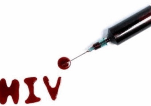 BREAKING: Once You Start Noticing These 3 Signs, You Might Be HIV/AIDS Positive Go For A Test