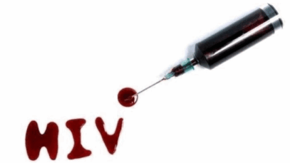 BREAKING: Once You Start Noticing These 3 Signs, You Might Be HIV/AIDS Positive Go For A Test