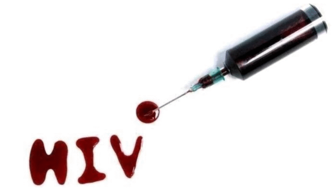 BREAKING: Once You Start Noticing These 3 Signs, You Might Be HIV/AIDS Positive Go For A Test