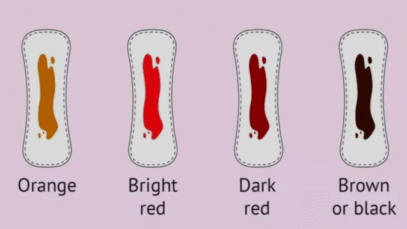 BREAKING NEWS: What every colour of your menstrual blood says about your health