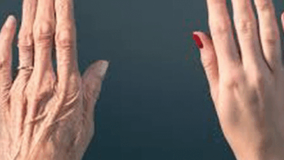 BREAKING: Wrinkles of hands will go away, just adopt this home method, difference will be visible in 10 days
