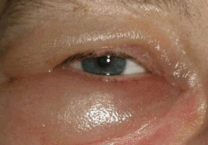 BREAKING: Pay Attention To Your Kidney Once You Notice These 5 Signs In Your Body