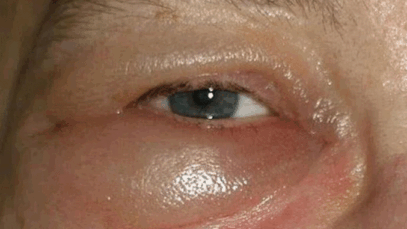 BREAKING: Pay Attention To Your Kidney Once You Notice These 5 Signs In Your Body