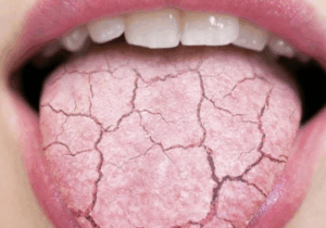 BREAKING: Your Blood Sugar Is High If You Feel The Following Symptoms